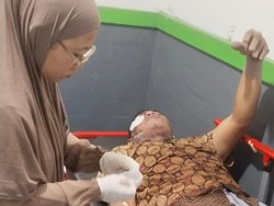 Pasutri Luka Bakar Kena Awan Panas Semeru Saat Melintasi Gladak Perak