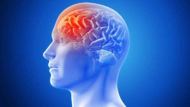 Wanita Ini Alami 5 Kali Kena Stroke Usai Pijat Kretek, Dokter Beri Peringatan