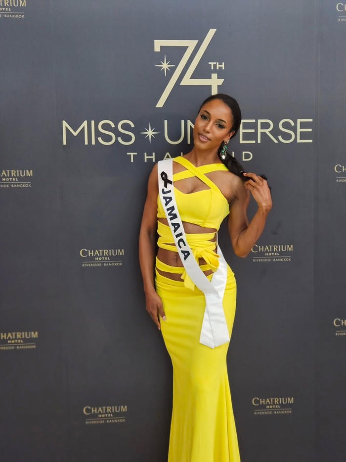 Laporan dari PEOPLE per Jumat (21/11) mengatakan bahwa Henry masih dirawat di unit perawatan intensif (ICU). Menurut Dr. Henry-Samuels, Henry berada dalam kondisi yang tidak sebaik yang mereka harapkan.