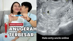 Hamil Anak Pertama, Amanda Manopo Pamer Hasil Test Pack