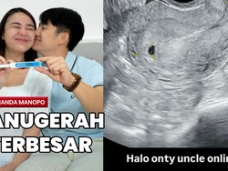 Hamil Anak Pertama, Amanda Manopo Pamer Hasil Test Pack