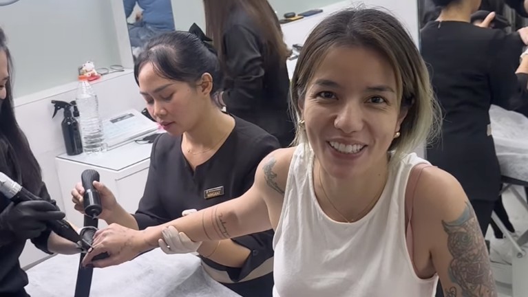 Momen ketika Sheila Marcia menahan sakit karena hapus tato.