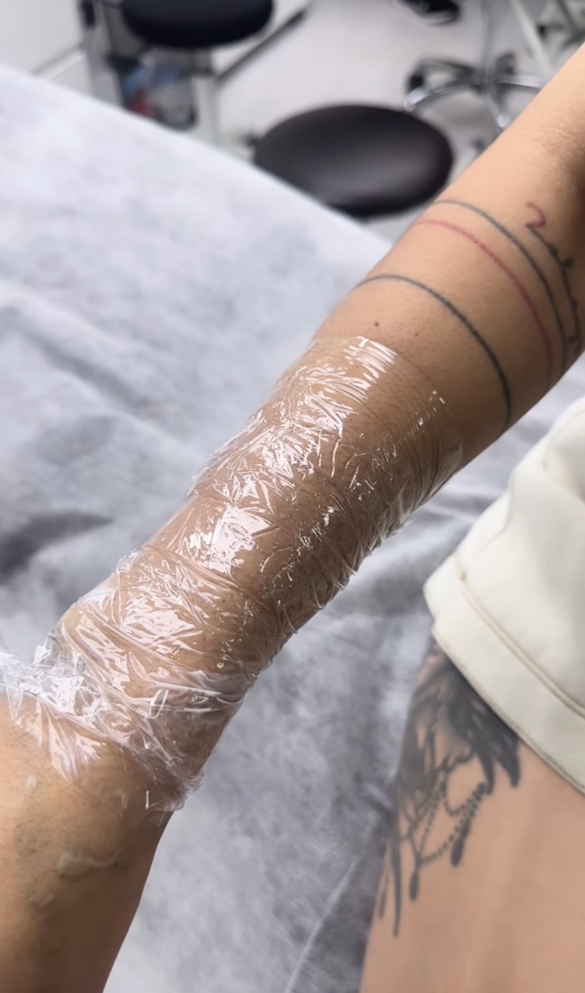 Momen ketika Sheila Marcia menahan sakit karena hapus tato&period;