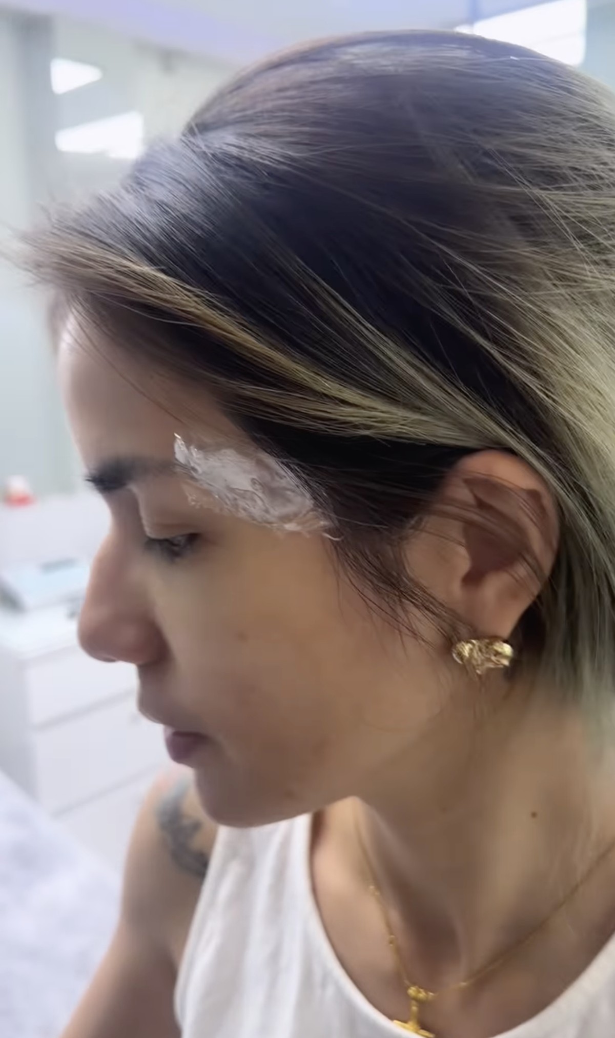 Momen ketika Sheila Marcia menahan sakit karena hapus tato&period;