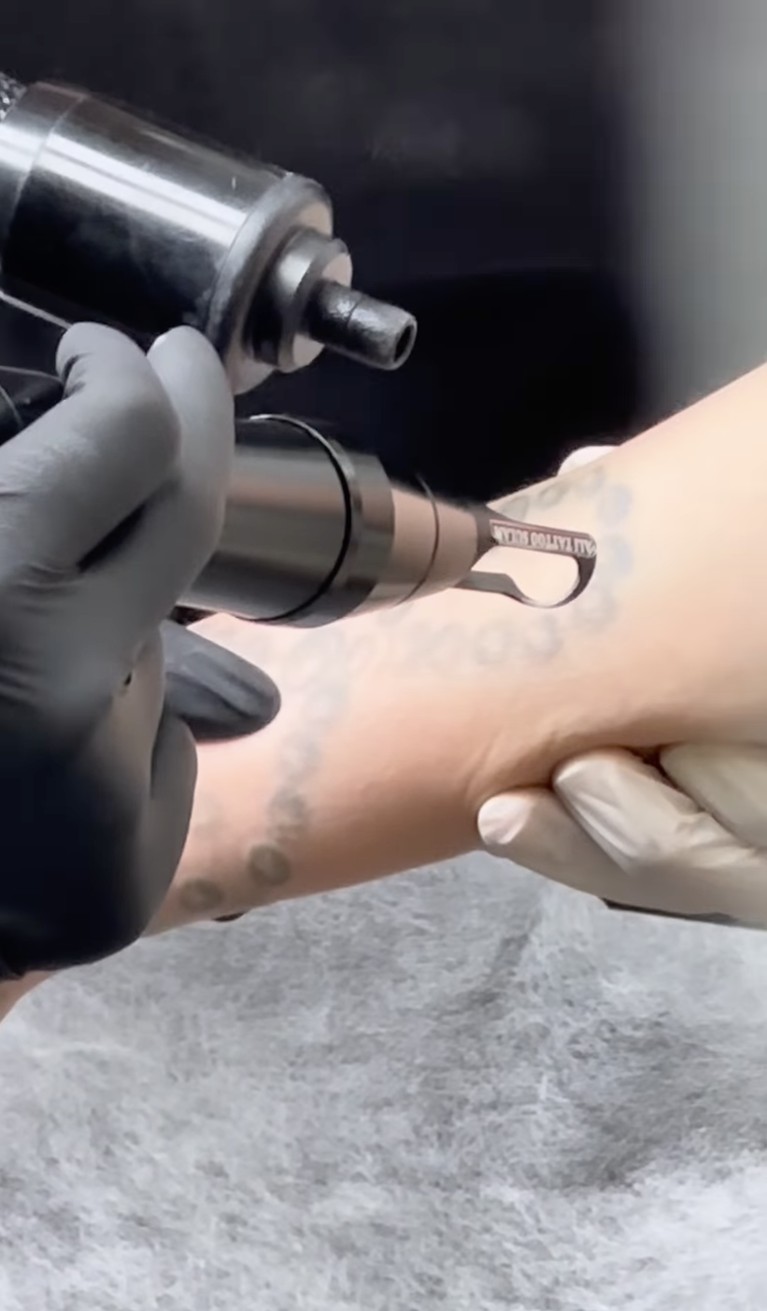 Momen ketika Sheila Marcia menahan sakit karena hapus tato.