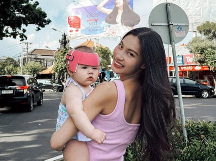 5 Potret Zoe Bertoli Anak Patricia Gouw Pakai Helm Anti Peyang, Terbaru Check Up ke Singapura