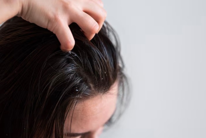 Rambut Porositas Rendah Memiliki Kutikula Rapat Sehingga Sulit Menyerap Kelembapan/Foto: freepik.com/freepik