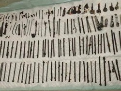 Ngilu! Dokter Temukan 120 Benda Asing di Perut Pasien, Ada Pisau-Gunting