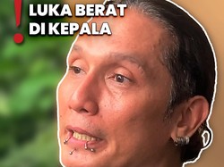 Video: Gary Iskak Alami Luka Berat di Kepala sebelum Meninggal