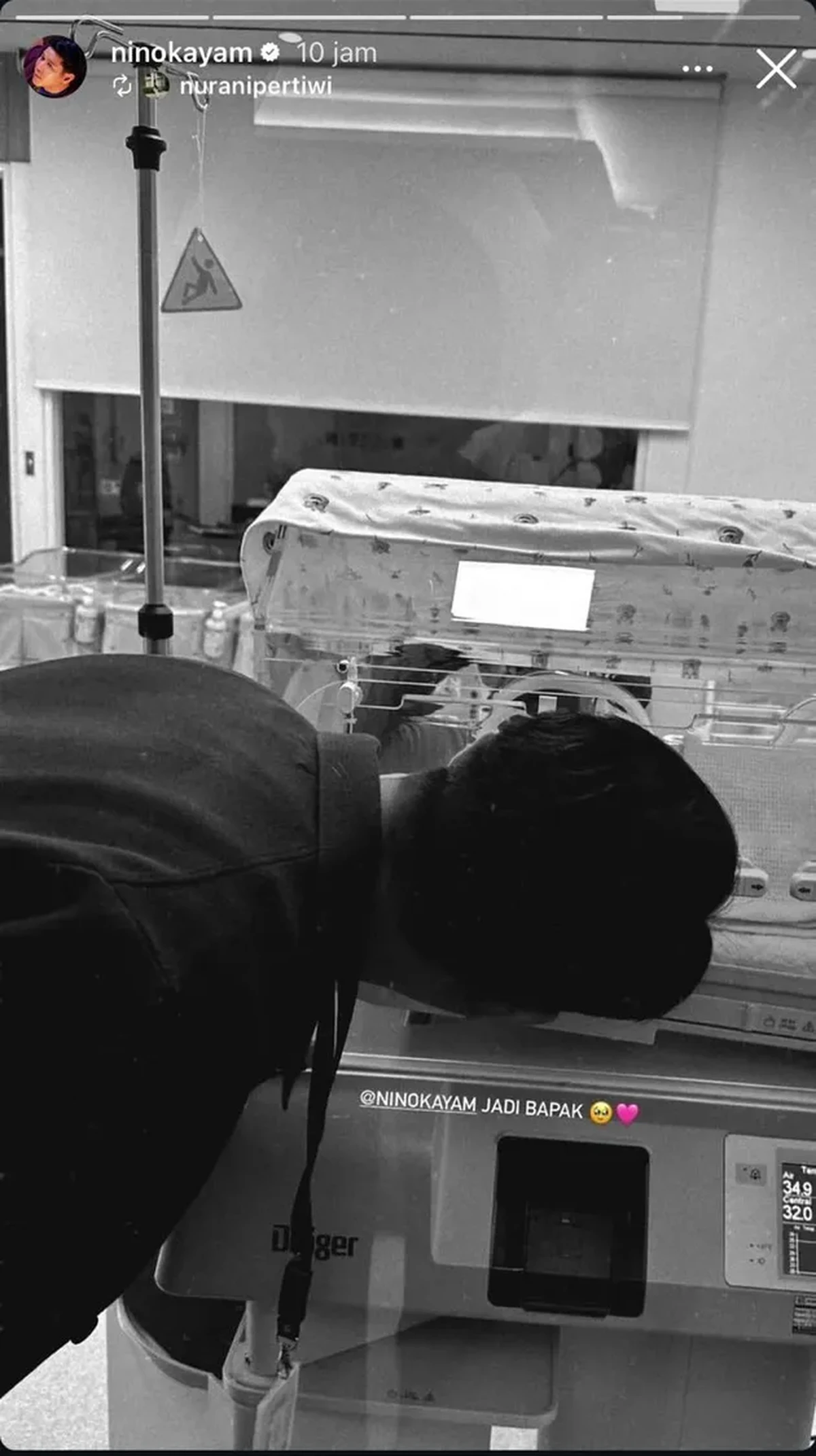 Istri Nino RAN Melahirkan