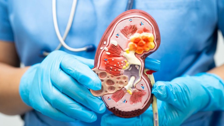 Kasus Kerusakan Ginjal pada Anak Meningkat, Ini yang Wajib Orang tua Ketahui