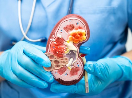 Kasus Kerusakan Ginjal pada Anak Meningkat, Ini yang Wajib Orang Tua Ketahui