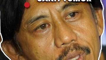 Video: Epy Pernah Divonis Hidup 4 Bulan-Pilih Pengobatan Herbal untuk Sembuh