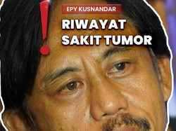 Video: Epy Pernah Divonis Hidup 4 Bulan-Pilih Pengobatan Herbal untuk Sembuh