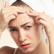 Breakout Terus? Ini 5 Makanan yang Jarang Disadari Bisa Bikin Jerawat Muncul!