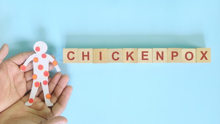 Chickenpox disease infection outbreak care, prevention and protection concept. Hand holding human body cutout with red rash sores and blisters on skin in blue background.