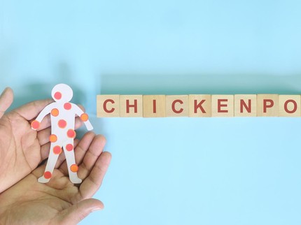 9 Gejala Awal Cacar Air yang Perlu Diwaspadai