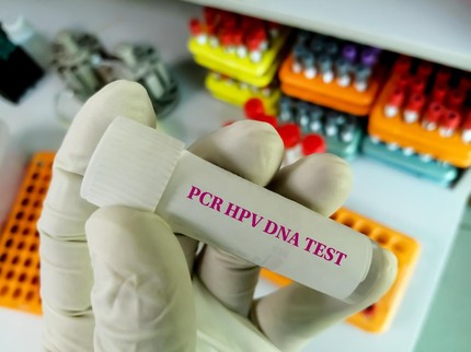 Tes HPV DNA, Alternatif untuk Mendeteksi Kanker Serviks Selain Pap Smear