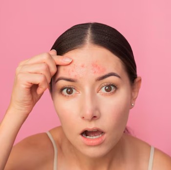 7 Kebiasaan Kecil yang Bisa Merusak Kulit Wajah Tanpa Kamu Sadari Menurut Para Ahli