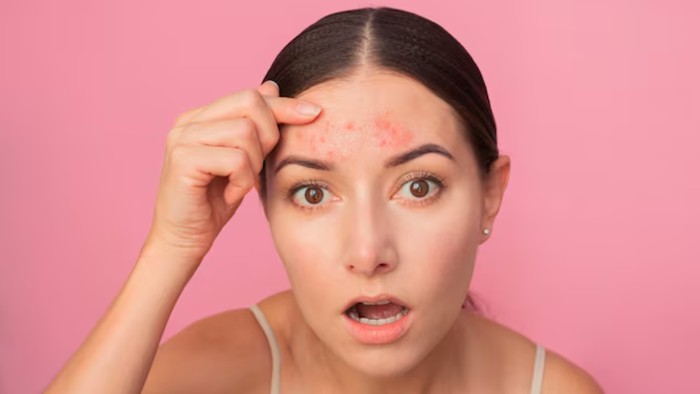 7 Kebiasaan Kecil yang Bisa Merusak Kulit Wajah Tanpa Kamu Sadari Menurut Para Ahli