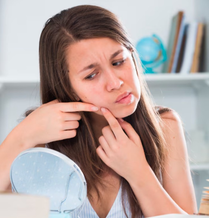 Penyebab jerawat muncul terus menerus karena sering menyentuh wajah/Foto: freepik.com/bearfotos