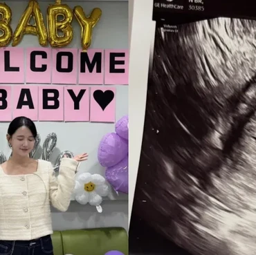 Aktris Nam Bo Ra Umumkan Kehamilan Anak Pertama