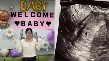 Aktris Nam Bo Ra Umumkan Kehamilan Anak Pertama