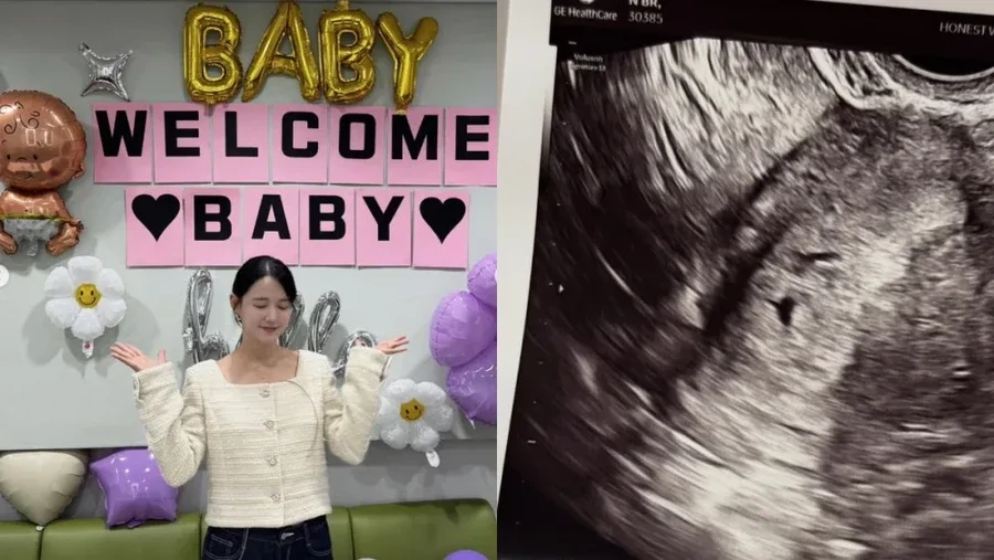 Aktris Nam Bo Ra Umumkan Kehamilan Anak Pertama