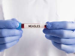 Ratusan Warga di AS Dikarantina usai Terinfeksi Virus Menular Ini