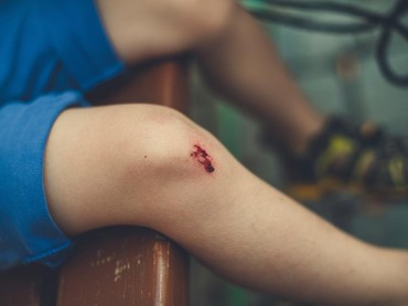 Mengenal Inovasi Octenidine dan Allantoin, Kandungan Antiseptik yang Aman untuk Anak