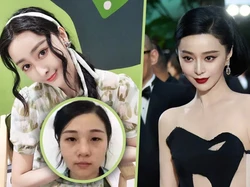 Wanita 37 Kali Oplas Demi Mirip Fan Bingbing, Akui Hidup Berubah & Menyesal