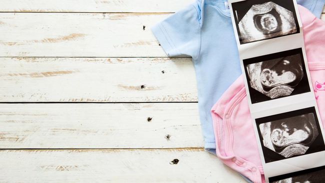 Kenapa Hasil USG Laki-laki Tapi saat Lahir Bayinya Perempuan? Ini Penjelasannya