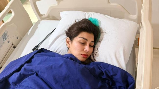 Nisya Adik Raffi Ahmad Alami Tumor di Kepala hingga Sempat Bernanah