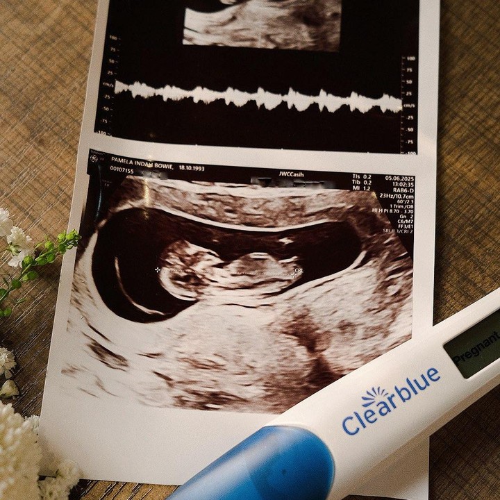 <p>Pamela Bowie pertama kali membagikan kabar kehamilan keduanya pada Juli 2025 lalu. Kabar ini ia umumkan setelah setahun melahirkan anak pertamanya, Bunda. Dalam pengumumkan kabar kehamilan keduanya, Pamela mengunggah foto test pack kehamilan positif dan foto USG bayinya. "<em>Oops we did it again!</em> (Oops kami melakukannya lagi!)," tulisnya dalam unggahan ini. (Foto: Instagram @pammybowie)</p>