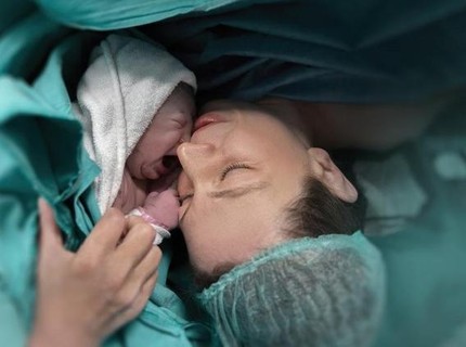 Jumlah Persalinan Caesar di Negara Ini Lebih Banyak daripada Pervaginam, Apa Penyebabnya?