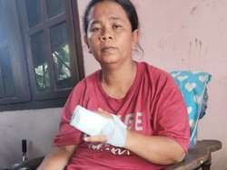 Wanita di Gresik Dianiaya Penagih Bank Plecit hingga Jarinya Patah