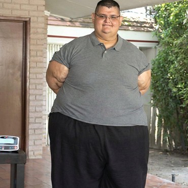 Tragis, Pria Tergemuk di Dunia Meninggal Usai Idap Penyakit Ini