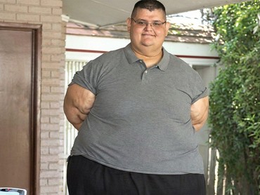 Tragis, Pria Tergemuk di Dunia Meninggal Usai Idap Penyakit Ini