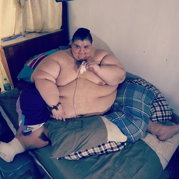 Kisah Juan Pedro, Pria Terberat di Dunia yang Meninggal karena Infeksi Ginjal