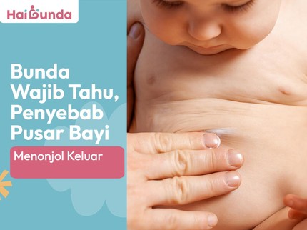 Bunda Wajib Tahu, Penyebab Pusar Bayi Menonjol Keluar