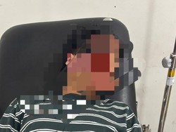 Pegawai Bank di Lampung Dianiaya Anak Purnawirawan Polri, Kepala Korban Luka