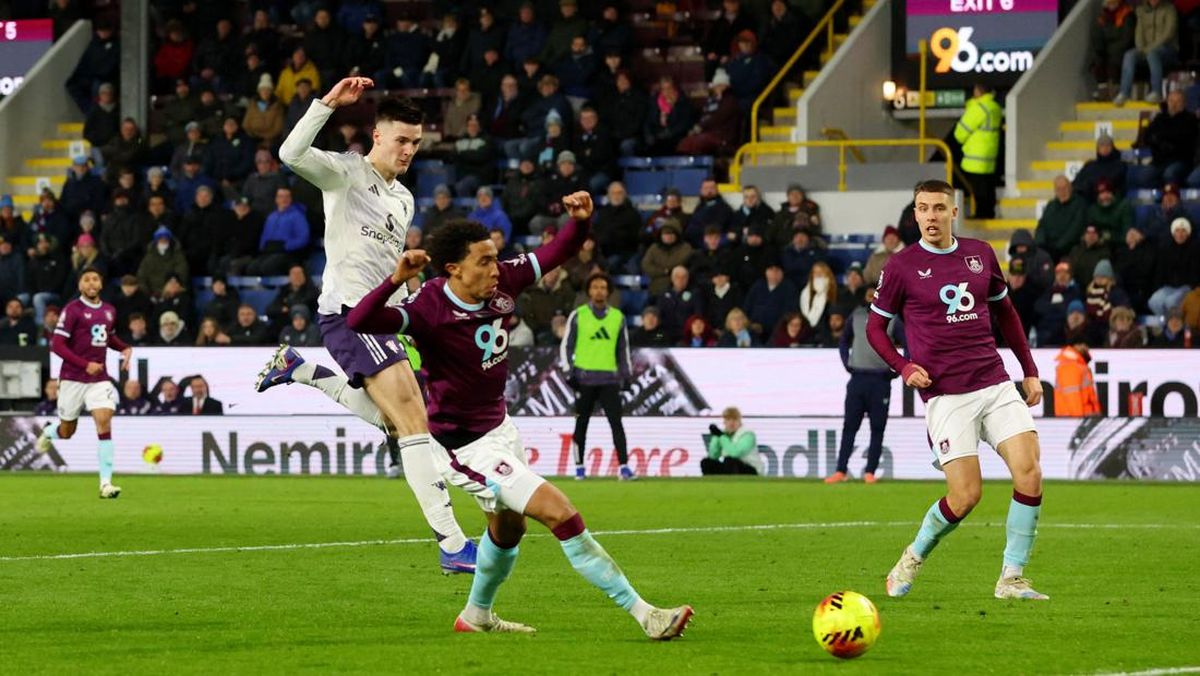 Sesko Diremehkan Usai Cetak Dua Gol di Burnley vs MU