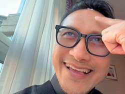 Kepala Bocor saat Umrah, Arie Untung Petik Hikmah Ini