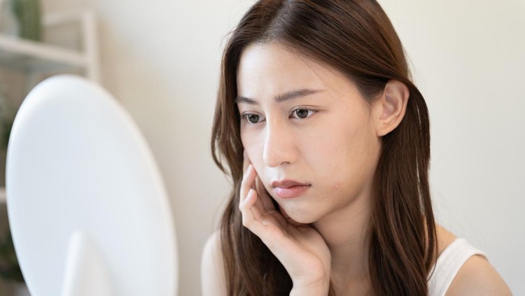 Young woman asian are worried about faces Dermatology and allergic to steroids in cosmetics&period; sensitive skin&comma; red face from sunburn&comma; acne&comma; allergic to chemicals&comma; rash on face&period; skin problems and beauty