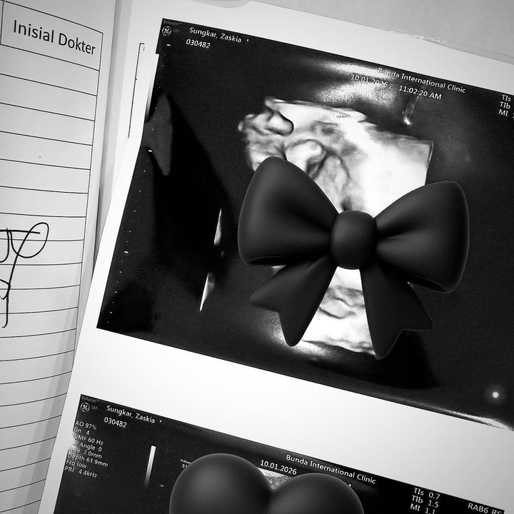 <p>Dalam unggahan ini, Zaskia juga menunjukkan foto USG bayi di dalam kandungannya yang berjenis kelamin laki-laki. Selain itu, ia juga mengungkap inisial nama calon adik dari Ukkasya. "<em>MasyaAllah Baby U</em>, mohon doanya," tulis Zaskia di Instagram. (Foto: Instagram @zaskiasungkar15)</p>