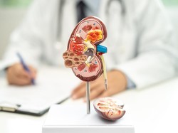 Peringatan dari Dokter, Kebiasaan Ini Picu Gagal Ginjal di Usia Muda