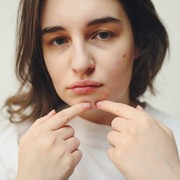 5 Makanan yang Pantang Dikonsumsi saat Berjerawat