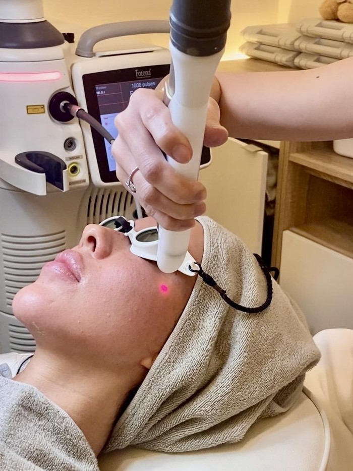 Potret Patricia Schuldtz saat menjalani perawatan kulit di Dermalogia