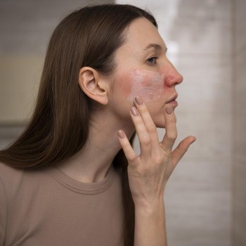 5 Kebiasaan yang Merusak Skin Barrier, Tanpa Disadari Mungkin Kamu Melakukannya!