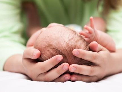 Mengenal Craniosynostosis, Kelainan Ubun-ubun Kepala yang Dialami Bayi Cantik Rana Asal Jatim